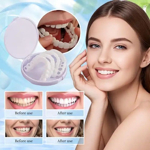 Snap On Smile - Snap On Smile